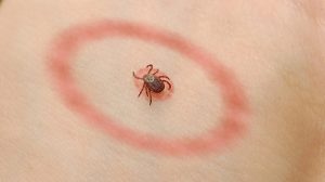 Read more about the article Alegeţi pantofi deschişi la culoare, fără orificii sau decupaje.Vine sezonul capuselor